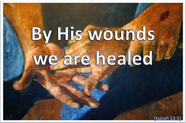 by his wounds we are healed